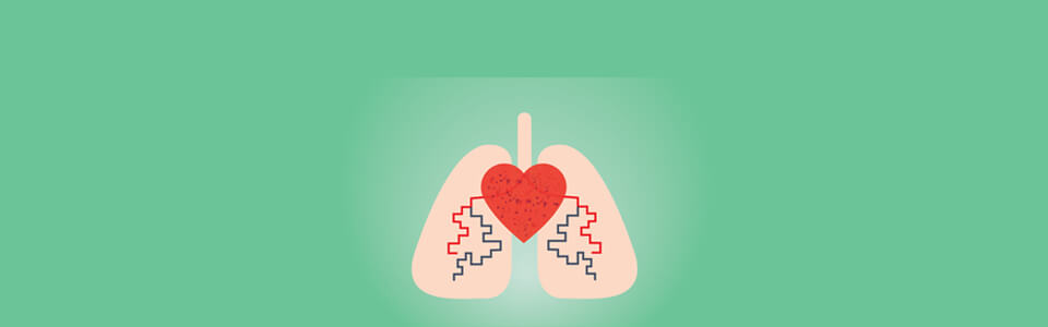 SLIDE PULMONARY 3